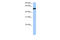 High Mobility Group 20A antibody, 27-695, ProSci, Western Blot image 