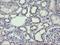 MDM4 antibody, NBP2-45779, Novus Biologicals, Immunohistochemistry frozen image 