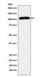 Receptor Tyrosine Kinase Like Orphan Receptor 2 antibody, M01840-1, Boster Biological Technology, Western Blot image 