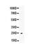 TNF Superfamily Member 4 antibody, A02554-1, Boster Biological Technology, Western Blot image 