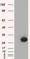 Cilia And Flagella Associated Protein 298 antibody, TA501350S, Origene, Western Blot image 