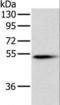 Pancreatic Lipase antibody, LS-C405230, Lifespan Biosciences, Western Blot image 