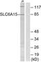 Solute Carrier Family 6 Member 15 antibody, A07589-1, Boster Biological Technology, Western Blot image 