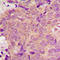 Palmitoyl-Protein Thioesterase 1 antibody, LS-C358836, Lifespan Biosciences, Immunohistochemistry paraffin image 