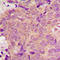 Palmitoyl-protein thioesterase 1 antibody, LS-C358836, Lifespan Biosciences, Immunohistochemistry paraffin image 