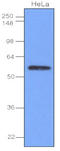 Interferon Regulatory Factor 3 antibody, LS-C93756, Lifespan Biosciences, Western Blot image 