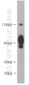 KIAA1041 antibody, 21240-1-AP, Proteintech Group, Western Blot image 
