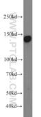 Tyrosine-protein kinase receptor UFO antibody, 13196-1-AP, Proteintech Group, Western Blot image 