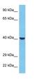 Inositol Polyphosphate-1-Phosphatase antibody, orb325931, Biorbyt, Western Blot image 