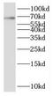 Potassium Voltage-Gated Channel Subfamily A Member 5 antibody, FNab04477, FineTest, Western Blot image 