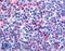 Fms Related Tyrosine Kinase 3 antibody, LS-A7142, Lifespan Biosciences, Immunohistochemistry frozen image 