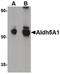 Aldehyde Dehydrogenase 5 Family Member A1 antibody, PA5-20609, Invitrogen Antibodies, Western Blot image 