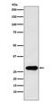 PTTG1 Regulator Of Sister Chromatid Separation, Securin antibody, M02099, Boster Biological Technology, Western Blot image 