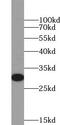 Mitochondrial uncoupling protein 3 antibody, FNab09229, FineTest, Western Blot image 