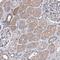 TRPM8 Channel Associated Factor 2 antibody, HPA038758, Atlas Antibodies, Immunohistochemistry frozen image 