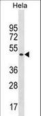 Splicing Factor 3b Subunit 4 antibody, LS-C156058, Lifespan Biosciences, Western Blot image 