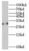 Synaptonemal Complex Protein 3 antibody, FNab07655, FineTest, Western Blot image 