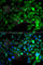 Decapping MRNA 1A antibody, A7376, ABclonal Technology, Immunofluorescence image 