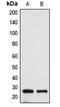 BCL2 Antagonist/Killer 1 antibody, LS-C351867, Lifespan Biosciences, Western Blot image 