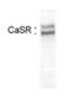 Calcium Sensing Receptor antibody, GTX19347, GeneTex, Western Blot image 