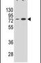 Ectonucleoside Triphosphate Diphosphohydrolase 3 antibody, PA5-24209, Invitrogen Antibodies, Western Blot image 