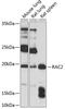 Rac Family Small GTPase 2 antibody, GTX64601, GeneTex, Western Blot image 