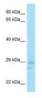 CCR4-NOT Transcription Complex Subunit 8 antibody, NBP1-98338, Novus Biologicals, Western Blot image 