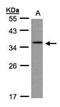 Crystallin Gamma C antibody, NBP1-32557, Novus Biologicals, Western Blot image 