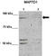 MAP7 Domain Containing 1 antibody, TA344931, Origene, Western Blot image 