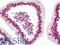 Snail Family Transcriptional Repressor 1 antibody, LS-B11351, Lifespan Biosciences, Immunohistochemistry paraffin image 