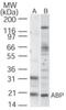 Potassium Voltage-Gated Channel Interacting Protein 1 antibody, NBP2-19020, Novus Biologicals, Western Blot image 