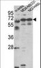 Fascin Actin-Bundling Protein 3 antibody, LS-C166055, Lifespan Biosciences, Western Blot image 