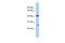 Potassium Calcium-Activated Channel Subfamily M Regulatory Beta Subunit 4 antibody, GTX47677, GeneTex, Western Blot image 