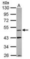 VRK Serine/Threonine Kinase 1 antibody, PA5-28687, Invitrogen Antibodies, Western Blot image 