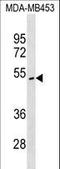 Inositol-Tetrakisphosphate 1-Kinase antibody, LS-C159946, Lifespan Biosciences, Western Blot image 