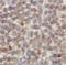 Cyclin D1 antibody, M00149-2, Boster Biological Technology, Immunohistochemistry paraffin image 