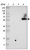 Pyruvate Dehyrogenase Phosphatase Catalytic Subunit 1 antibody, PA5-53815, Invitrogen Antibodies, Western Blot image 