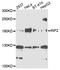 Inverted Formin, FH2 And WH2 Domain Containing antibody, abx135956, Abbexa, Western Blot image 