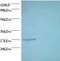 Proteasome Subunit Alpha 7 antibody, LS-C211127, Lifespan Biosciences, Western Blot image 