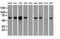 Checkpoint Kinase 2 antibody, NBP1-47695, Novus Biologicals, Western Blot image 