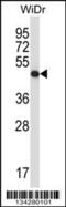 Ubiquinol-Cytochrome C Reductase Core Protein 2 antibody, 57-693, ProSci, Western Blot image 