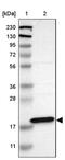 Ankyrin Repeat Domain 22 antibody, PA5-53010, Invitrogen Antibodies, Western Blot image 