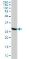 Cyclin Dependent Kinase 4 antibody, H00001019-M04, Novus Biologicals, Western Blot image 