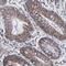 Zinc Finger Protein 550 antibody, HPA003251, Atlas Antibodies, Immunohistochemistry frozen image 