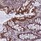 GTPase, IMAP Family Member 1 antibody, HPA044887, Atlas Antibodies, Immunohistochemistry paraffin image 