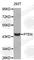 Phosphatase And Tensin Homolog antibody, A0008, ABclonal Technology, Western Blot image 