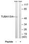 Tubulin Alpha 4a antibody, TA326208, Origene, Western Blot image 