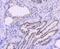 DNA Polymerase Beta antibody, A01946-2, Boster Biological Technology, Immunohistochemistry paraffin image 