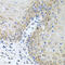 Carboxypeptidase M antibody, 22-316, ProSci, Immunohistochemistry paraffin image 