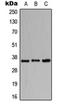 Bone Marrow Stromal Cell Antigen 1 antibody, orb213618, Biorbyt, Western Blot image 
